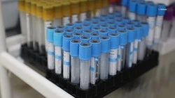 Проверяться на гепатит C нужно ежегодно — минздрав Ставрополья 