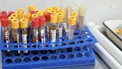 На Ставрополье показатель заболеваемости ВИЧ-инфекцией за год снизился на 4,6%